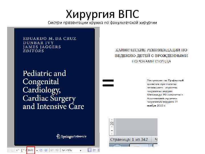 Хирургия ВПС Смотри презентации кружка по факультетской хирургии = 