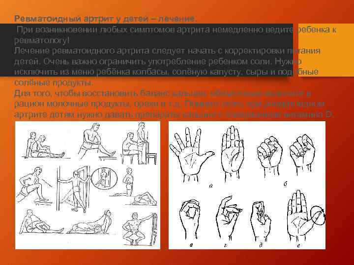 Ревматоидный артрит у детей – лечение. При возникновении любых симптомов артрита немедленно ведите ребенка
