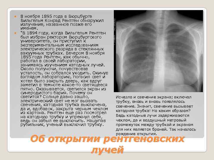  8 ноября 1895 года в Вюрцбурге Вильгельм Конрад Рентген обнаружил излучение, названное позже