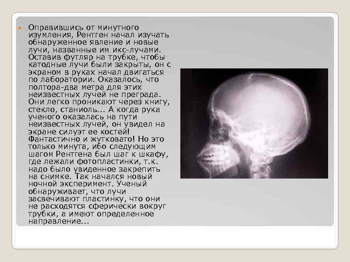  Оправившись от минутного изумления, Рентген начал изучать обнаруженное явление и новые лучи, названные