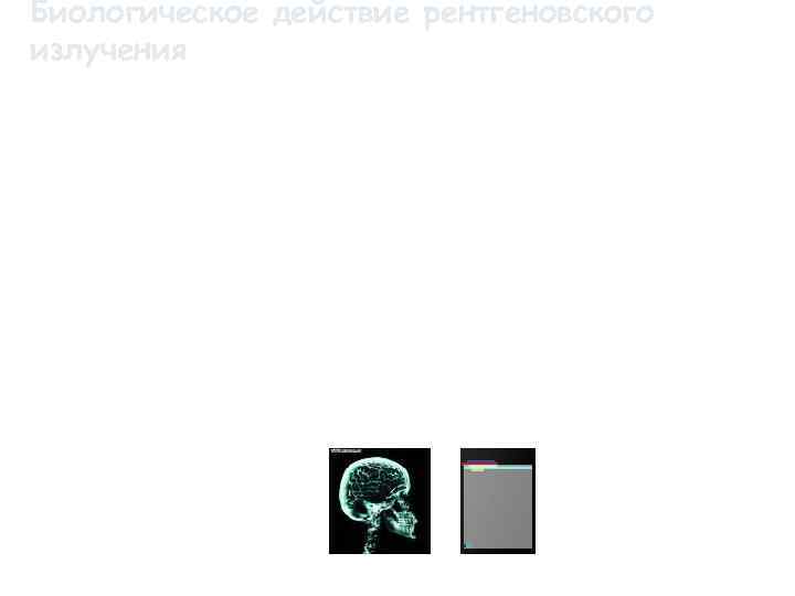 Биологическое действие рентгеновского излучения Вредное биологическое действие рентгеновского излучения обнаружилось вскоре после его открытия