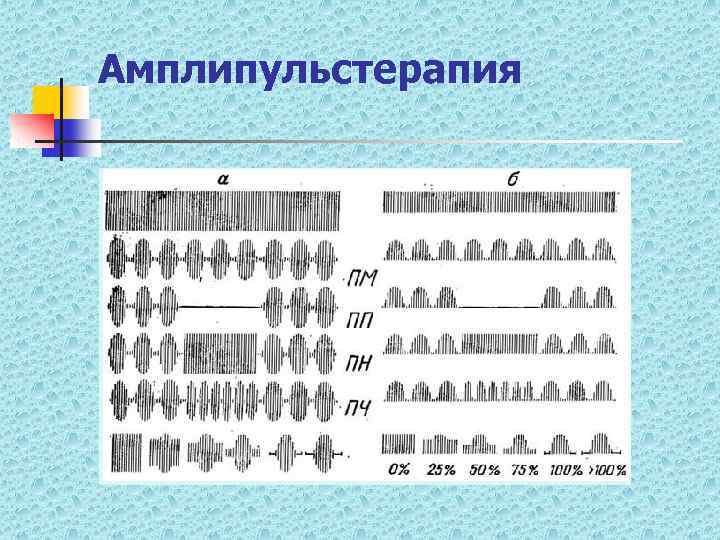 Амплипульстерапия 
