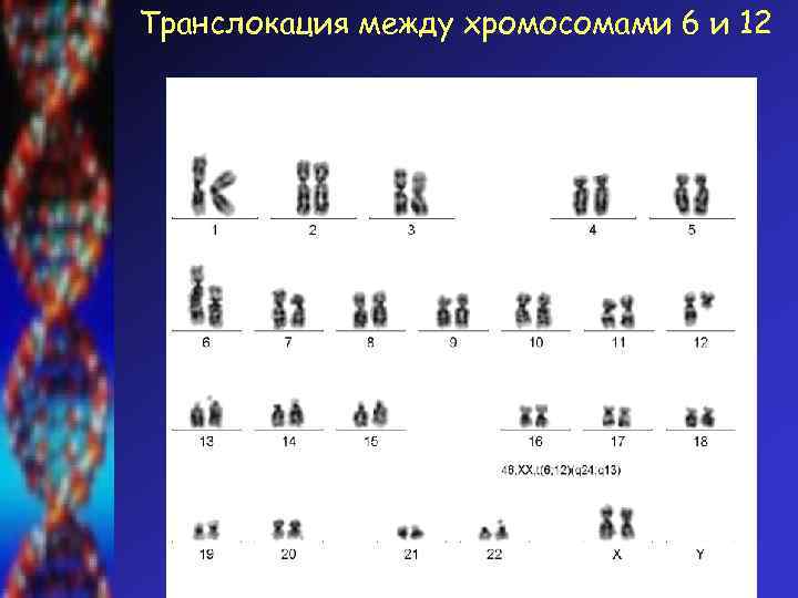 Транслокация между хромосомами 6 и 12 