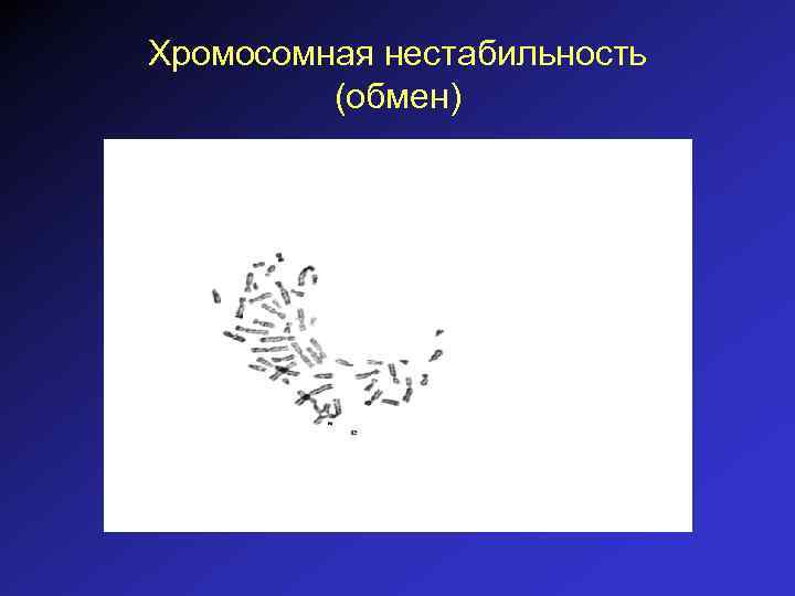 Хромосомная нестабильность (обмен) 