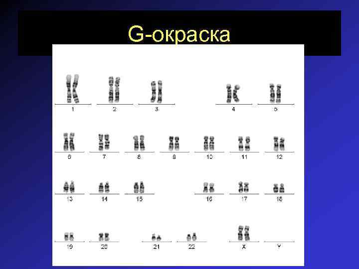 G-окраска 