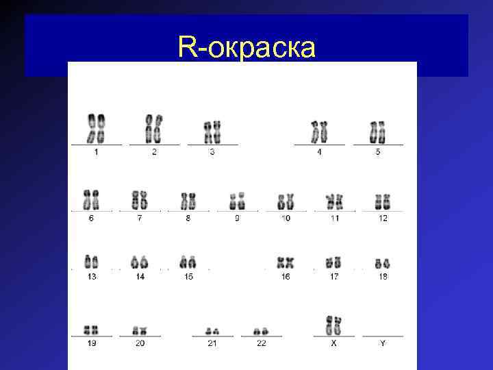 R-окраска 
