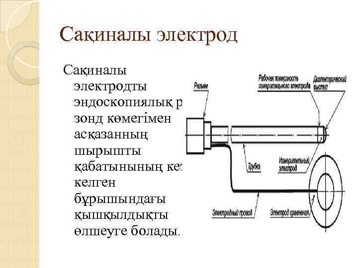 Сақиналы электродты эндоскопиялық р. Н зонд көмегімен асқазанның шырышты қабатынының кезкелген бұрышындағы қышқылдықты өлшеуге