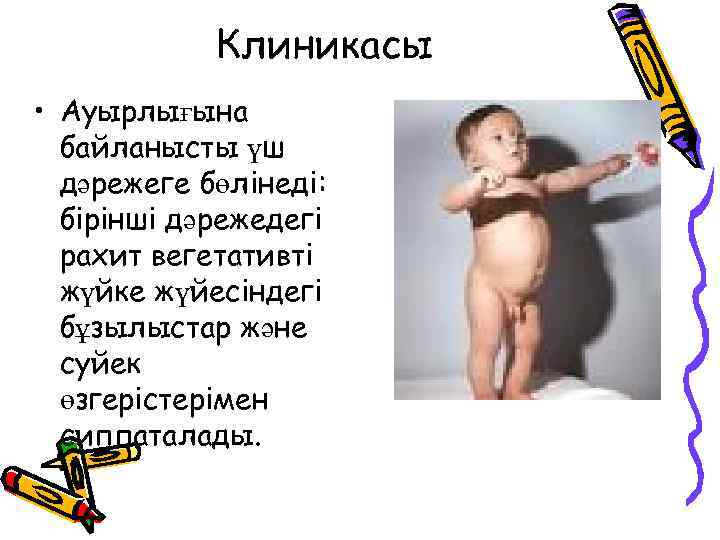 Клиникасы • Ауырлығына байланысты үш дәрежеге бөлінеді: бірінші дәрежедегі рахит вегетативті жүйке жүйесіндегі бұзылыстар