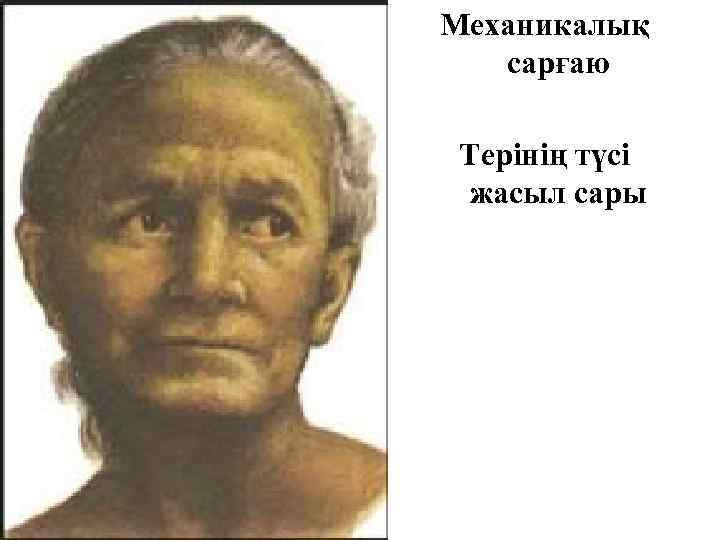 Механикалық сарғаю Терінің түсі жасыл сары 