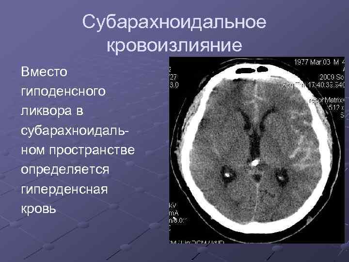 Компьютерная томография головного мозга где сделать