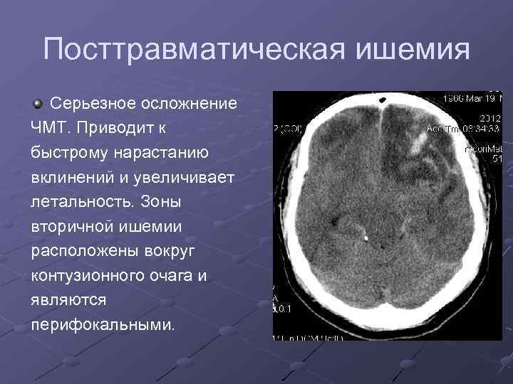 Компьютерная томография головного мозга где сделать