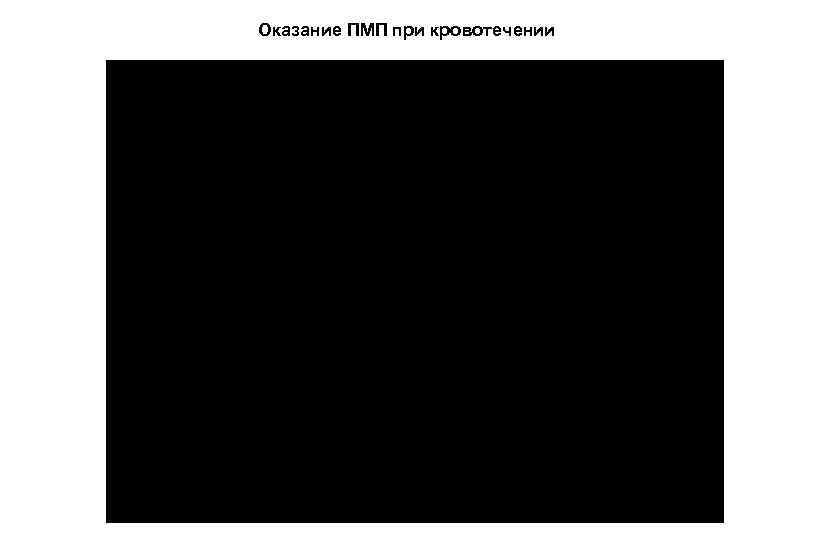 Оказание ПМП при кровотечении 