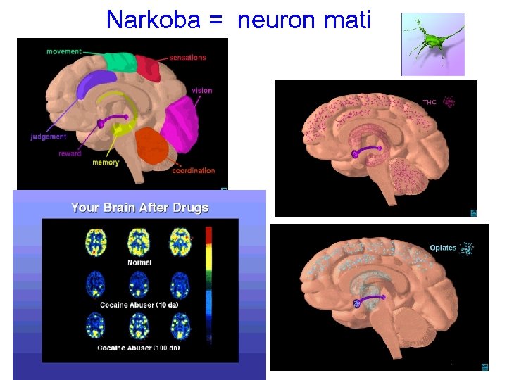 Narkoba = neuron mati 