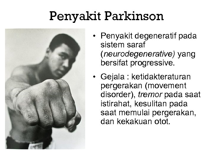 Penyakit Parkinson • Penyakit degeneratif pada sistem saraf (neurodegenerative) yang bersifat progressive. • Gejala