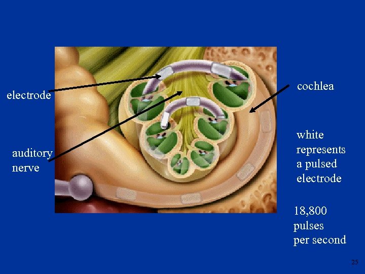 electrode auditory nerve cochlea white represents a pulsed electrode 18, 800 pulses per second