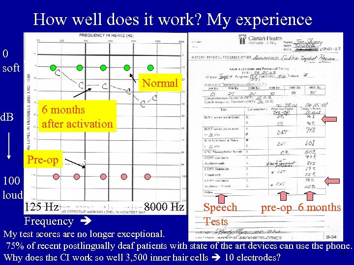 How well does it work? My experience 0 soft Normal d. B 6 months
