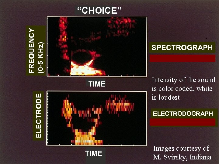 FREQUENCY (0 -5 KHz) “CHOICE” SPECTROGRAPH ELECTRODE TIME Intensity of the sound is color
