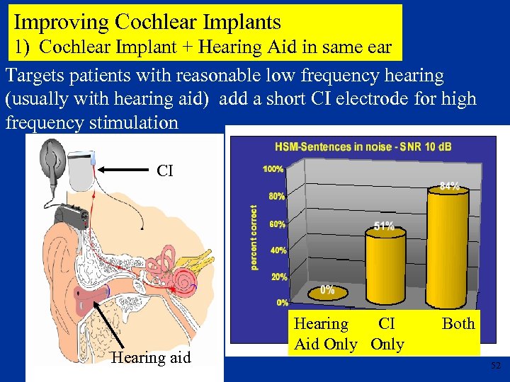 Improving Cochlear Implants 1) Cochlear Implant + Hearing Aid in same ear Targets patients