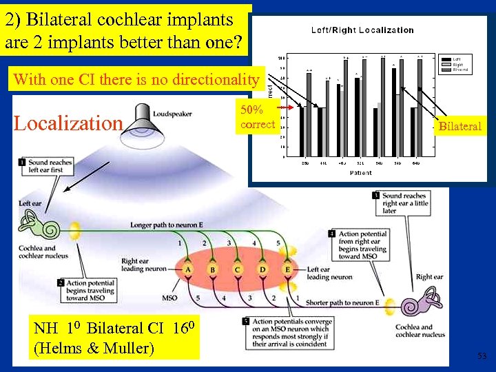 2) Bilateral cochlear implants are 2 implants better than one? With one CI there