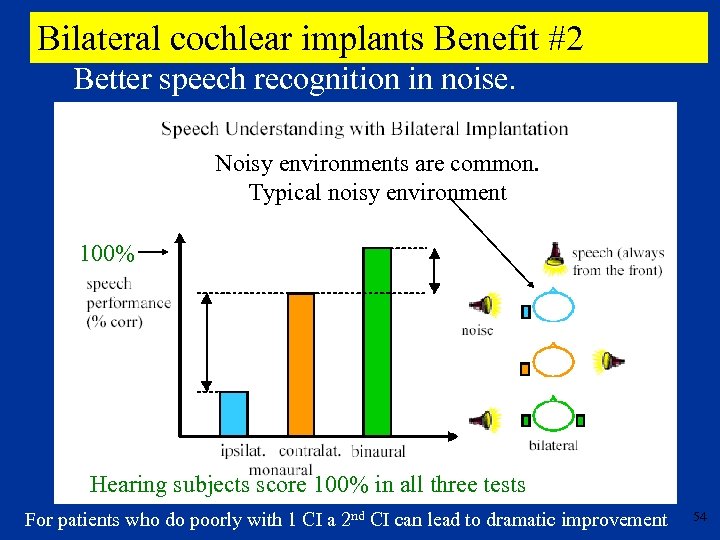 Bilateral cochlear implants Benefit #2 Better speech recognition in noise. Noisy environments are common.