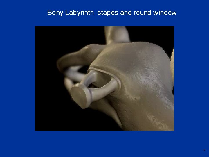 Bony Labyrinth stapes and round window 7 