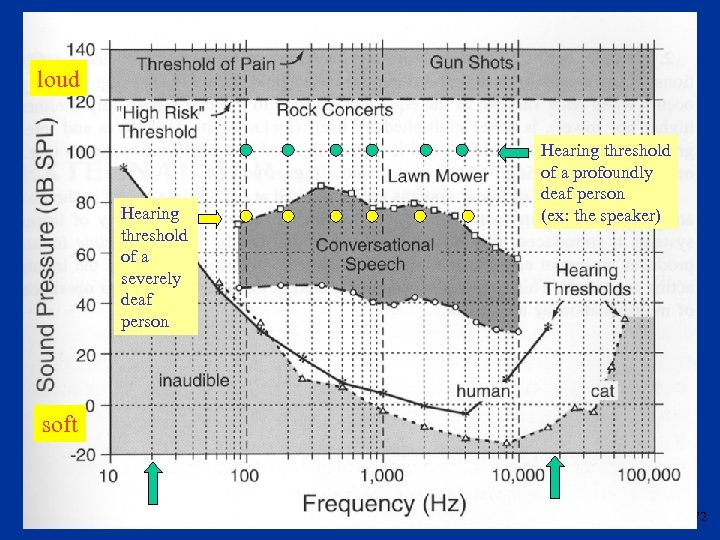 loud Hearing threshold of a severely deaf person Hearing threshold of a profoundly deaf