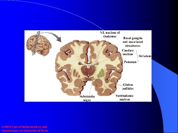 INRIM Unit of Radiochemistry and Spectroscopy c/o University of Pavia 