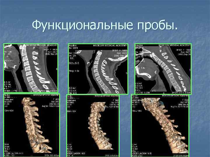 Функциональные пробы. 