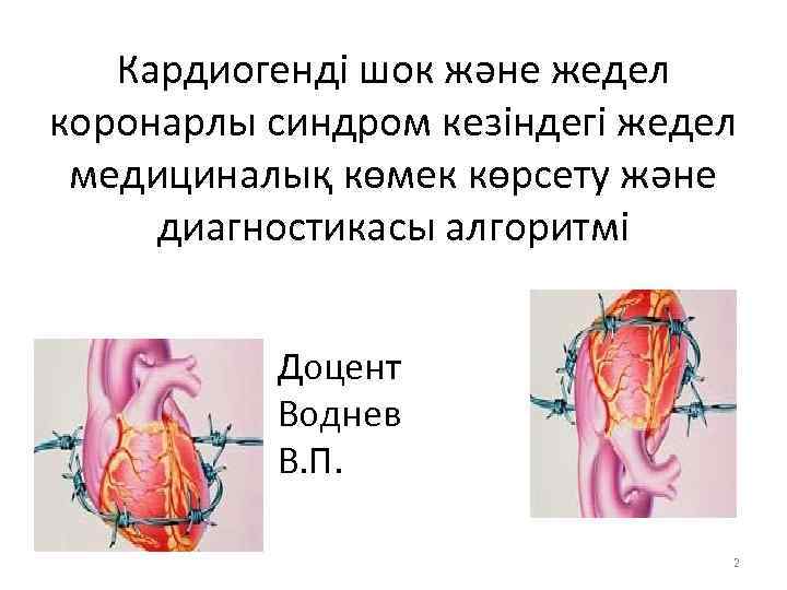 Жедел коронарлы синдром презентация