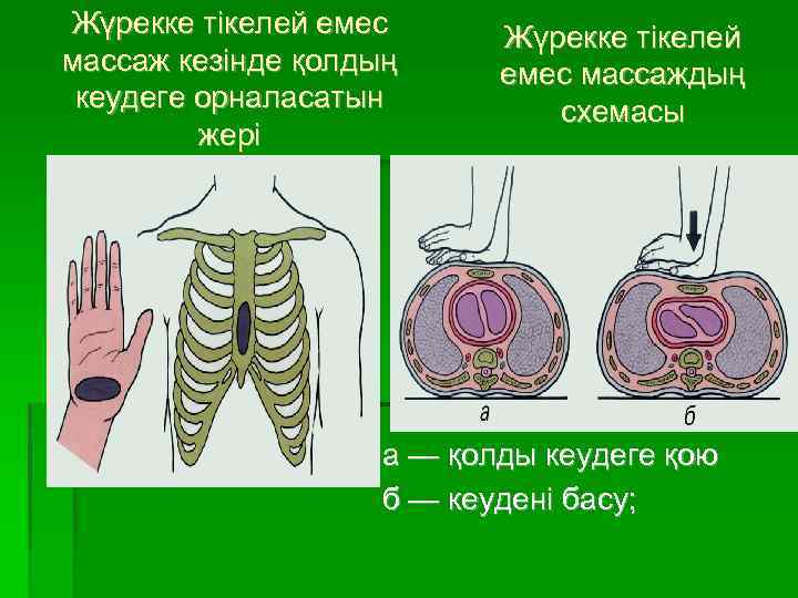 Жүрекке тікелей емес массаж кезінде қолдың кеудеге орналасатын жері Жүрекке тікелей емес массаждың схемасы