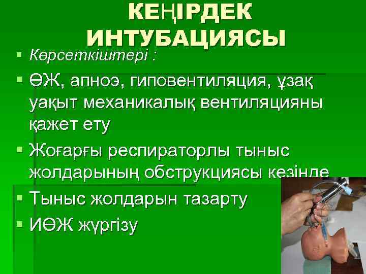 КЕҢІРДЕК ИНТУБАЦИЯСЫ § Көрсеткіштері : § ӨЖ, апноэ, гиповентиляция, ұзақ уақыт механикалық вентиляцияны қажет