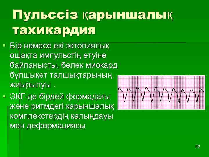 Пульссіз қарыншалық тахикардия § Бір немесе екі эктопиялық ошақта импульстің өтуіне байланысты, бөлек миокард