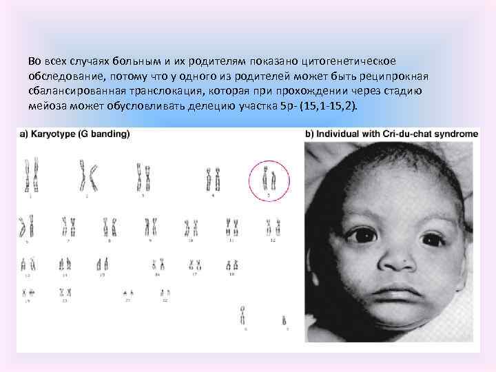 Во всех случаях больным и их родителям показано цитогенетическое обследование, потому что у одного