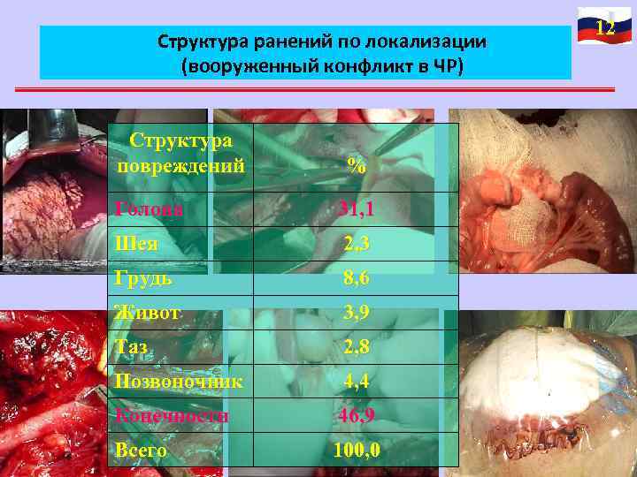 Структура ранений по локализации (вооруженный конфликт в ЧР) Структура повреждений % Голова 31, 1