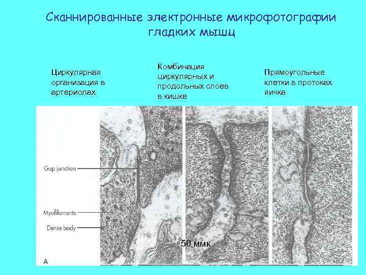 Сканнированные электронные микрофотографии гладких мышц Циркулярная организация в артериолах Комбинация циркулярных и продольных слоев