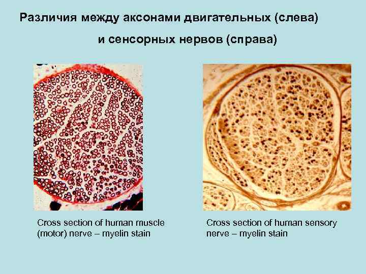 Различия между аксонами двигательных (слева) и сенсорных нервов (справа) Cross section of human muscle