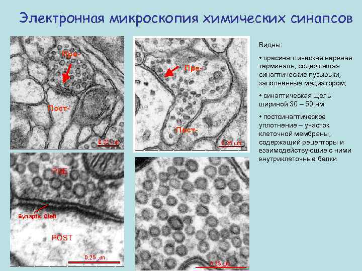 Электронная микроскопия химических синапсов Видны: Пре- • пресинаптическая нервная терминаль, содержащая синаптические пузырьки, заполненные