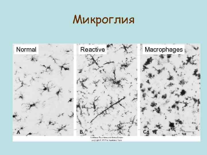 Микроглия Normal Reactive Macrophages 