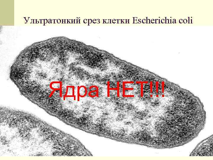 Ультратонкий срез клетки Escherichia coli Ядра НЕТ!!! 