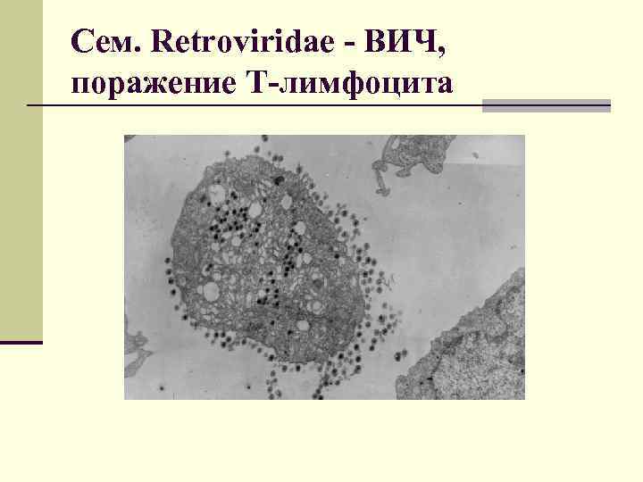 Сем. Retroviridae - ВИЧ, поражение Т-лимфоцита 