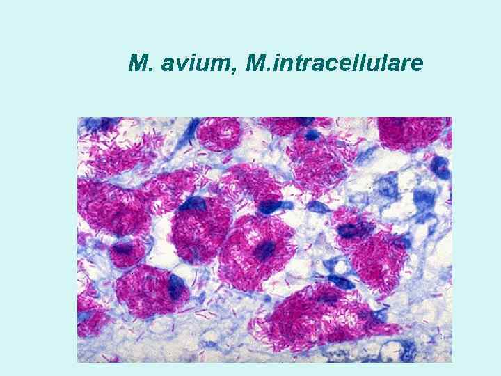 M. avium, M. intracellulare 