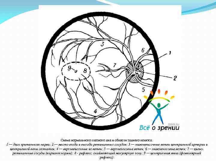 Схема нормального глазного дна в области заднего полюса. 1 — диск зрительного нерва; 2