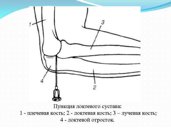 На рисунке изображен сустав тазобедренный локтевой запястный коленный