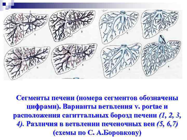 Сегменты печени (номера сегментов обозначены цифрами). Варианты ветвления v. portae и расположения сагиттальных борозд