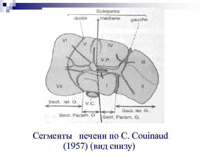 Сегменты печени по С. Couinaud (1957) (вид снизу) 
