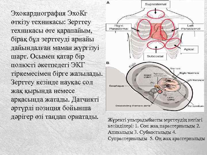 Эхокардиография Эхо. Кг өткізу техникасы: Зерттеу техникасы өте қарапайым, бірақ бұл зерттеуді арнайы дайындалған