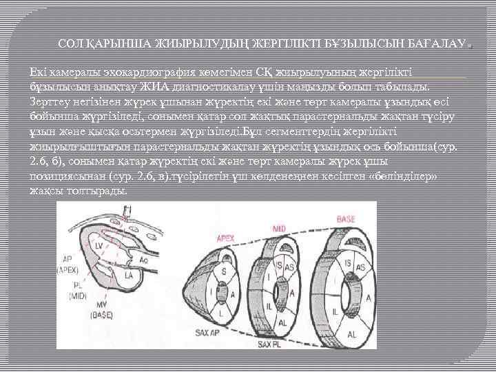 СОЛ ҚАРЫНША ЖИЫРЫЛУДЫҢ ЖЕРГІЛІКТІ БҰЗЫЛЫСЫН БАҒАЛАУ Екі камералы эхокардиография көмегімен СҚ жиырылуының жергілікті бұзылысын