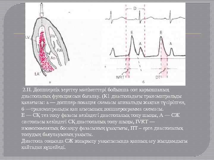 2. П. Допплерлік зерттеу мәліметтері бойынша сол қарыншаның диастолалық функциясын бағалау. (К 1 диастоладағы