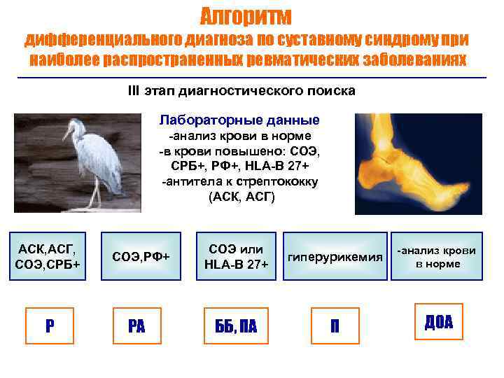 Алгоритм дифференциального диагноза по суставному синдрому при наиболее распространенных ревматических заболеваниях III этап диагностического