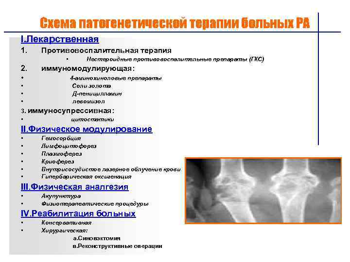 Клиническая картина ревматоидного артрита